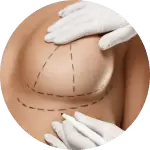 Breast Lift Package