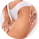 Thigh Liposuction Package
