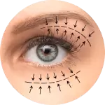 Eyelid Surgery Package
