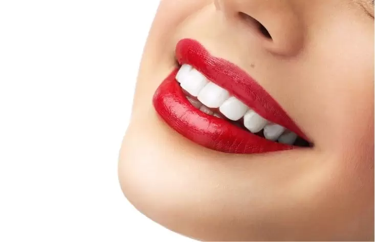The Actual Process of Hollywood Smile Treatment