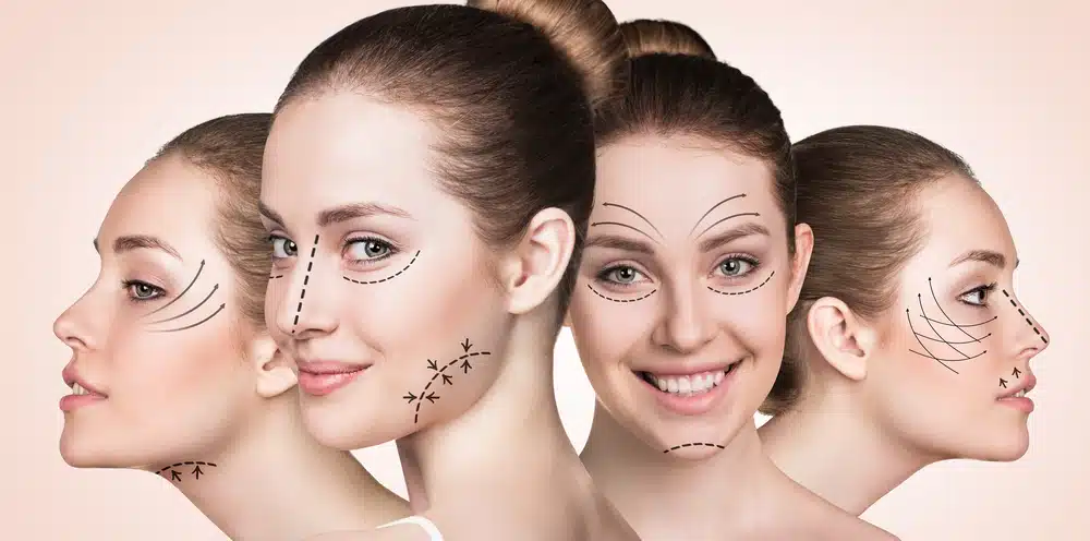 Can other surgeries be performed along with rhinoplasty