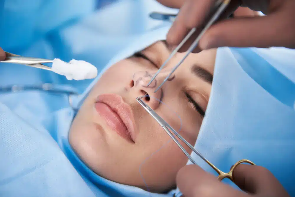 Nose Surgery Techniques