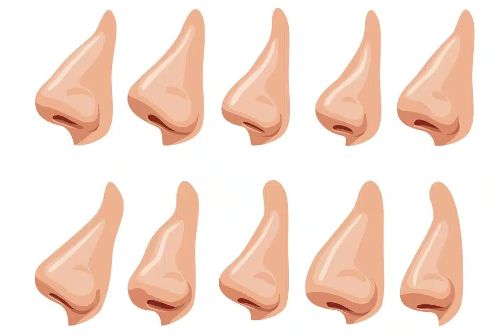 Types of Noses Changes of The Nose under Rhinoplasty