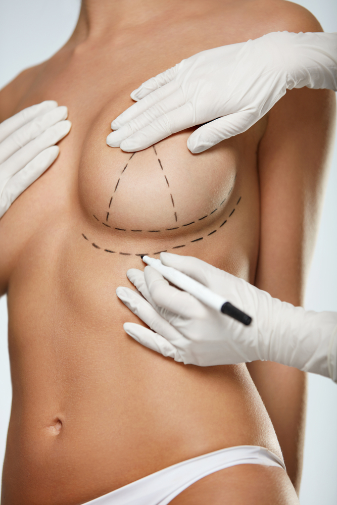 Scars from breast lift & enlargement