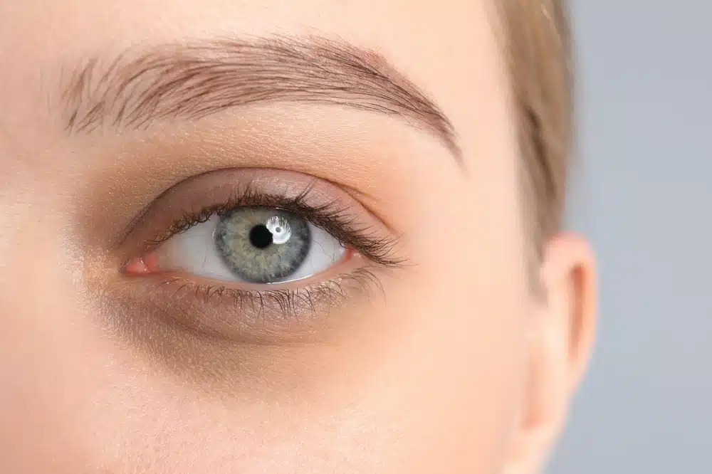 What to Expect After Blepharoplasty