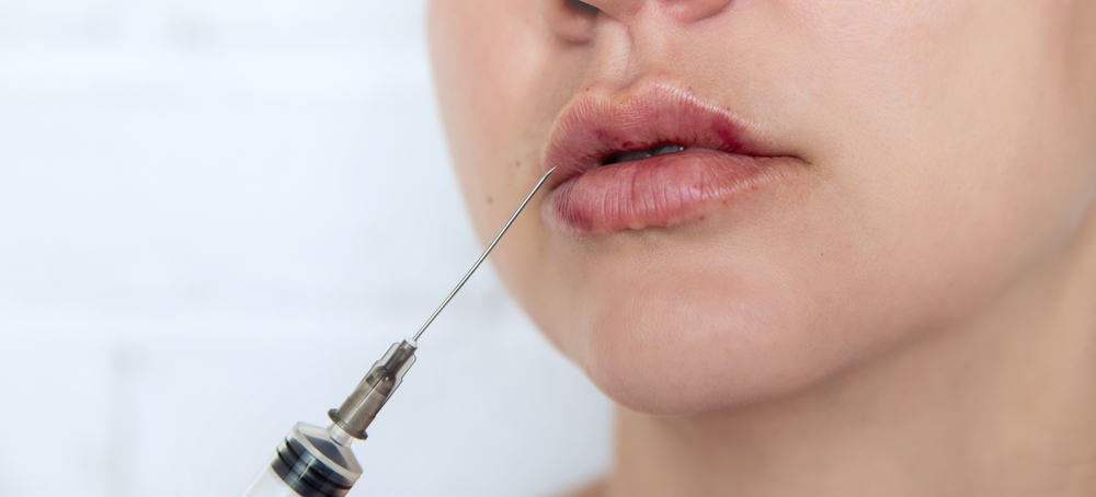 Can Lip Fillers Cause Scars Or Cold Sores
