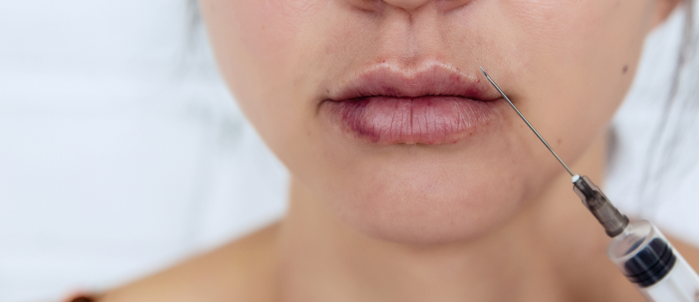 Can lip fillers cause scars or cold sores