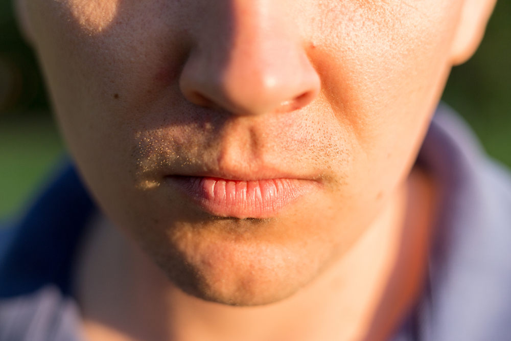 11. ¿La exposición al sol es perjudicial para los rellenos de labios?