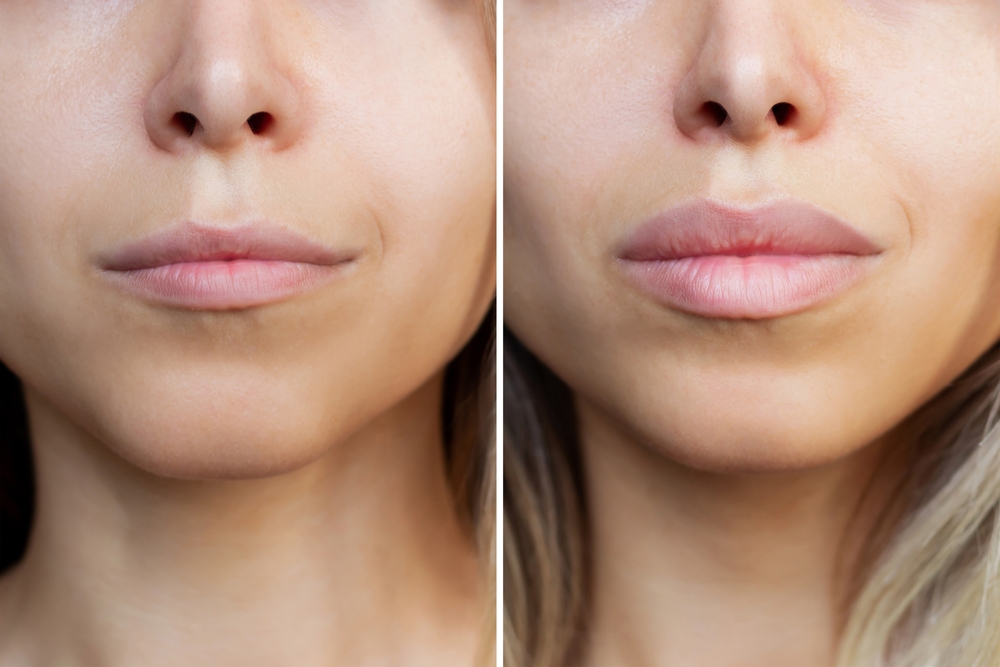 Know the Anatomy of Your Lips 