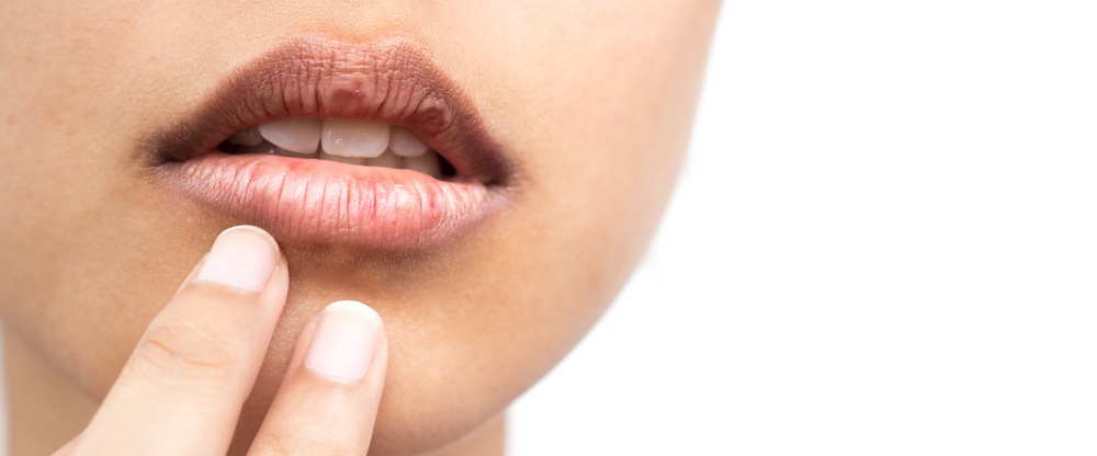 Swelling and bruising are common after lip injections